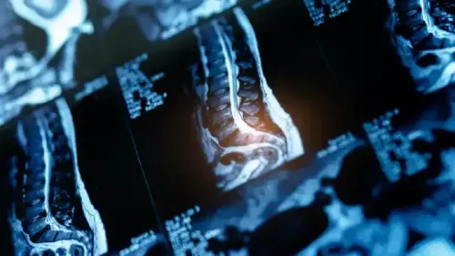 What is the Average Cost of Spinal MRI?